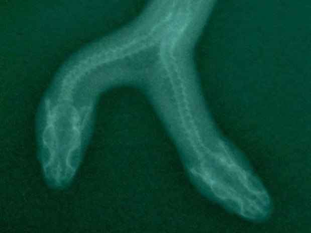 Raio-x mostra como as duas cabeças são unidas à medula espinhal da falsa coral , que tem quase um metro de comprimento(foto: Venice Beach Freakshow/Reprodução) Raio-x mostra como as duas cabeças são unidas à medula espinhal da falsa coral , que tem quase um metro de comprimento(foto: Venice Beach Freakshow/Reprodução)