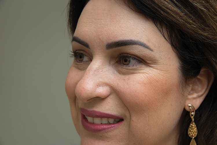 Rosangela Moreira fez reparação nas sobrancelhas, que eram muito ralas: Rosangela Moreira fez reparação nas sobrancelhas, que eram muito ralas: